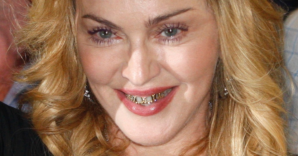 21.ago.2013 - Madonna exibe acessório dourado nos dentes em Roma, Itália