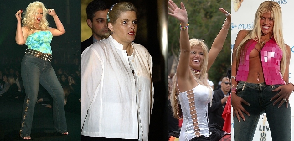 Anna Nicole Smith engordou bastante após seus anos como coelhinha da "Playboy". A ex-modelo começou a ganhar peso em 2001, mas em 2003 ela já estava magra de novo. Smith morreu no dia 8 de fevereiro de 2007