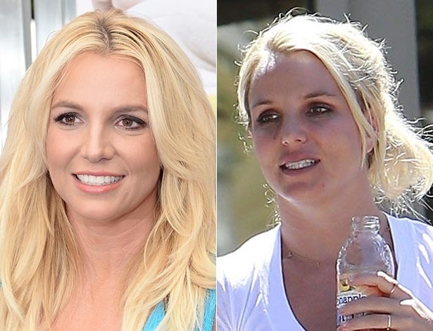 Britney Spears em fotos de julho e setembro. Na segunda, ela exibe lábios mais grossos do que na outra