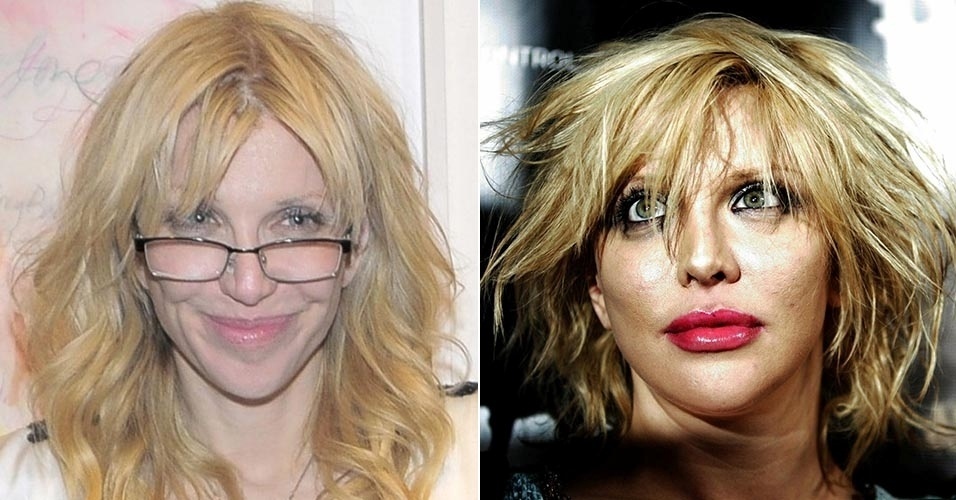 Viúva de Kurt Cobain, Courtney Love deixou os lábios bem maiores com o preenchimento labial