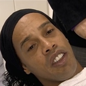 "Fantástico" exibe reportagem sobre correção dos dentes de Ronaldinho