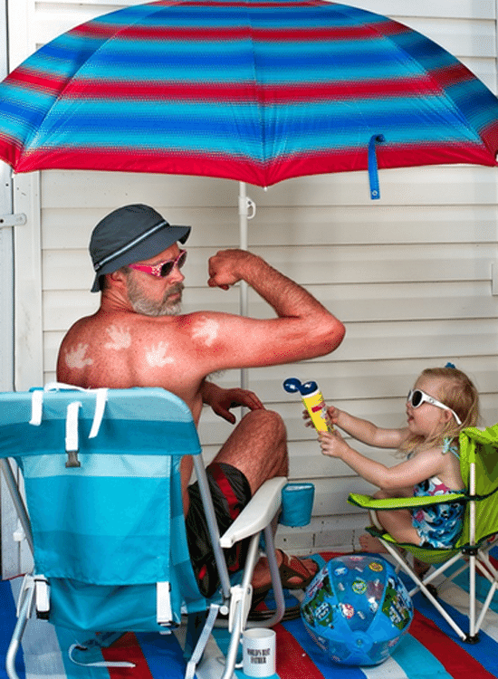 Sunburn - Dave Engledow