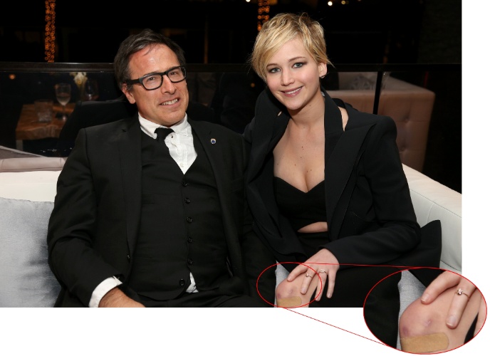 8.nov.2013 - A queridinha da América e vencedora do Oscar Jennifer Lawrence apareceu com o joelho esquerdo marcado por hematomas e usando um band-aid durante homenagem ao diretor de seu próximo filme, "Trapaça - O Filme", David O. Russel, no festival AFI, em Hollywood