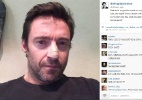 Hugh Jackman revela que tratou câncer de pele no nariz - Reprodução/Instagram