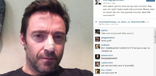 21.nov.2013 - Hugh Jackman publica foto com curativo no nariz. Ator revelou que teve câncer de pele no nariz