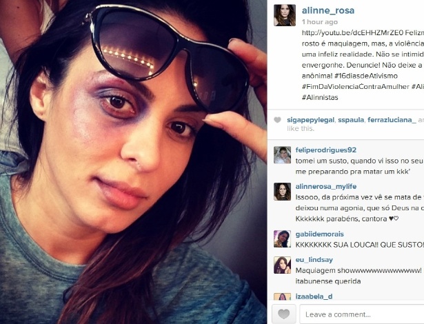 11.dez.2013- Alinne Rosa posa com o olho roxo. ""Felizmente isso no meu rosto é maquiagem, mas, a violência contra a mulher é uma infeliz realidade"