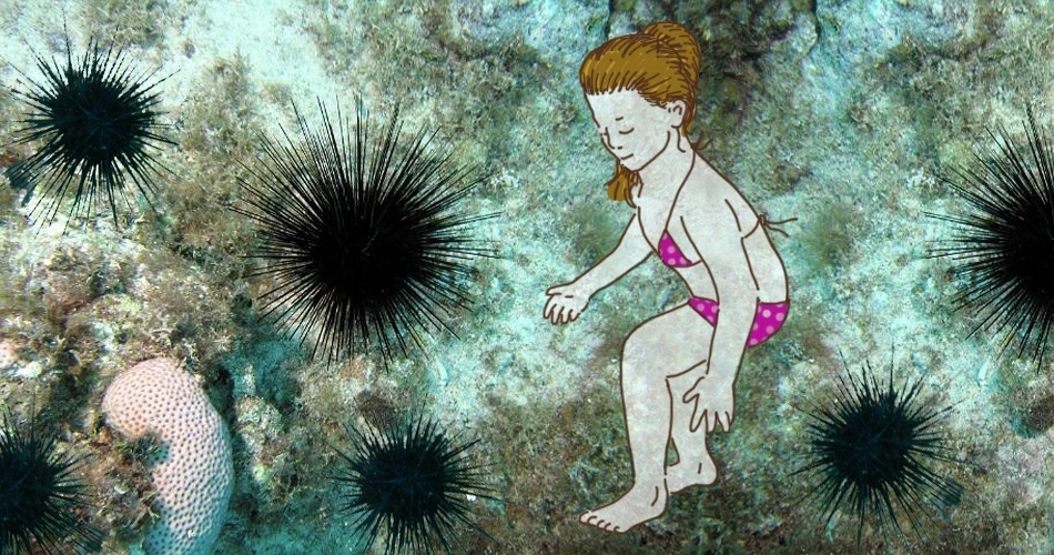 MACHUCADO POR OURIÇO-DO-MAR: os ouriços encontrados no Brasil não costumam conter o veneno que causa reações sistêmicas graves, como paralisias musculares e arritmias cardíacas. Esses tipos são mais comuns na região dos oceanos Índico e Pacífico. Mesmo assim, pisar ou esbarrar nos exemplares nacionais exige cuidados. Seus espinhos têm substâncias irritantes e o principal problema é a espícula quebrada que fica dentro da pele, causando dor, vermelhidão e inchaço - Didi Cunha/UOL