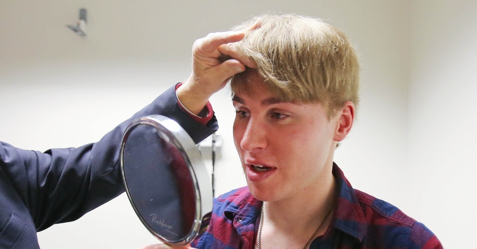 4.fev.2013 - Toby Sheldon, de 33 anos, fez aplicação de botox para ficar parecido com seu ídolo, o cantor Justin Bieber