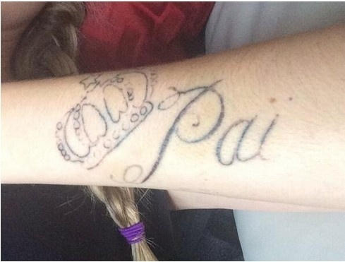 21.fev.2014 - Bárbara Evans, que no final de 2013 fez uma tatuagem que virou motivo de piada na internet, pelos traços não tão perfeitos, começou o processo de remoção logo em seguida