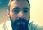 Hugh Jackman conta que precisou tratar outro câncer de pele no nariz - Reprodução/Instagram