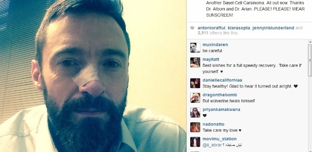 Hugh Jackman usou o Instagram para alertar sobre o câncer de pele