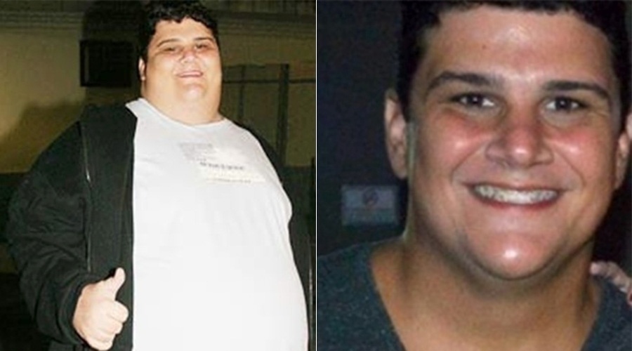 O ator Renato Franco perdeu 100 quilos