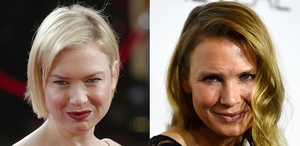 Antes e depois do rosto da atriz Renée Zellweger - Getty Images
