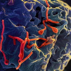 Em vermelho, o vírus ebola, que recebe esse nome por ter sido descoberto em um paciente infectado próximo ao rio Ebola, localizado no Congo - NIAID / Flickr / CC BY 2.0