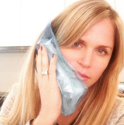 30.jan.2015 - Susana Werner passou a sexta-feira (30) com dor devido a um tratamento dentário. "O primeiro implante a gente nunca esquece!", escreveu ela em post no Instagram