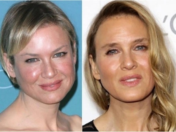A atriz Renée Zellweger, 45 anos, também foi alvo de comentários ao comparecer a um evento de uma revista feminina com o rosto visivelmente modificado, em outubro de 2014 - Andrew Toth/Getty Images