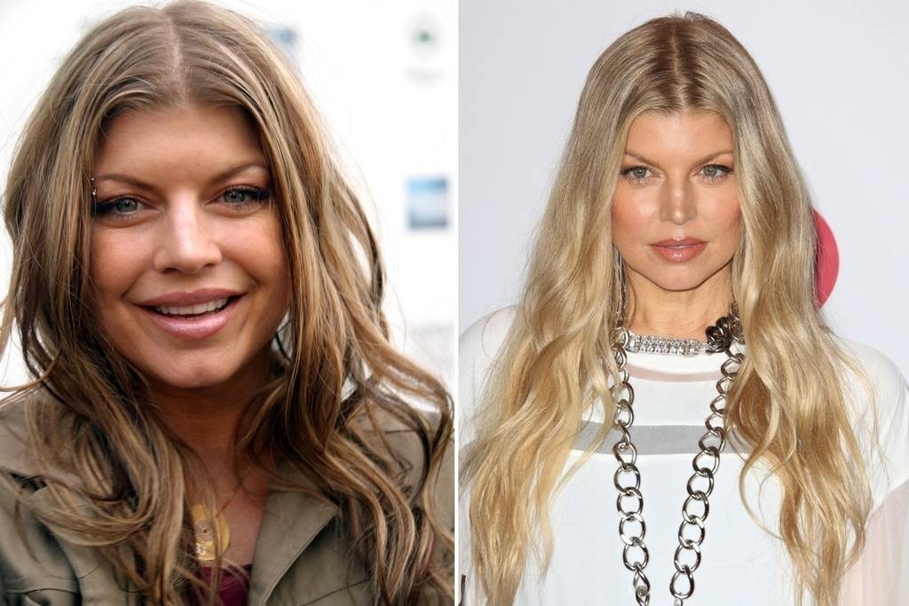 A cantora Fergie tem hoje um visual bem diferente de quando começou na banda Black Eyed Peas e já foi "acusada" de ter aplicado Botox no rosto e de ter feito preenchimento facial e lifting nas sobrancelhas - Reprodução/Rex