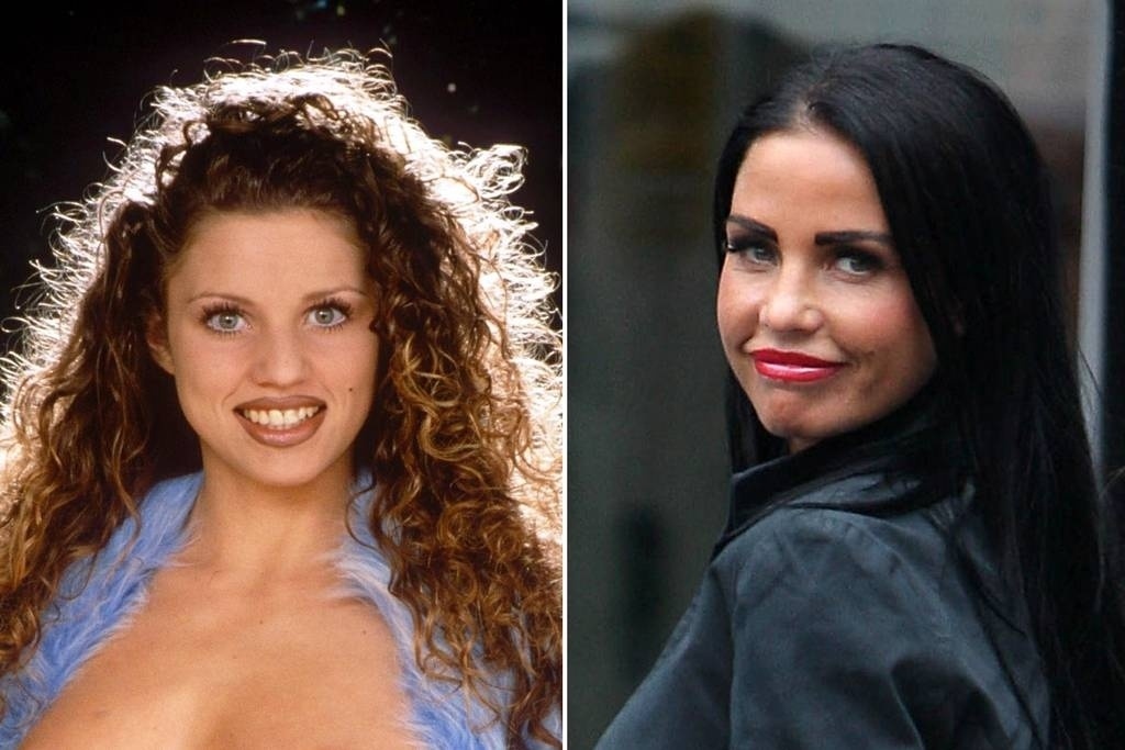 A modelo britânica Katie Price ficou irreconhecível depois de passar por aplicações de Botox, cirurgias no nariz e lipoaspirações no rosto - Reprodução/Rex