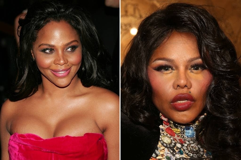 A rapper Lil' Kim causou furor na imprensa norte-americana ao aparecer com o rosto totalmente transformado, fruto de várias cirurgias no nariz, clareamentos de pele e reconstruções ósseas - Reprodução/Getty Images