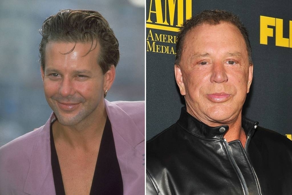 Hoje praticamente irreconhecível, o ator Mickey Rourke passou por diversas cirurgias plásticas para reverter os danos causados ao seu rosto pelos anos em que lutou como boxeador - Reprodução