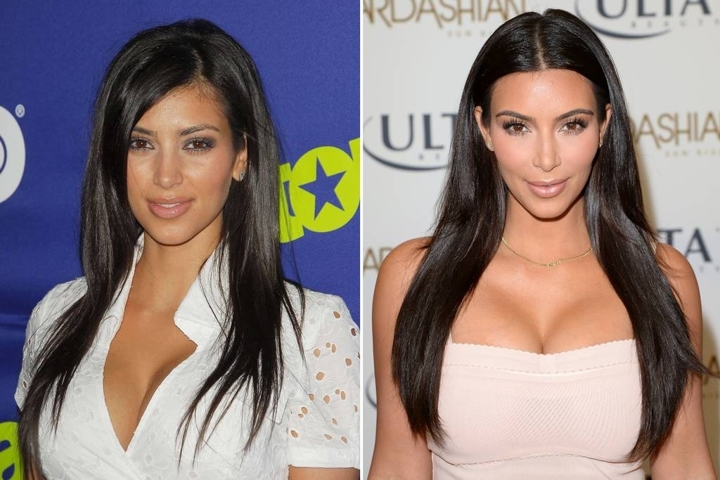 Kim Kardashian também já passou por diversas transformações. Acredita-se que a socialite americana tenha operado o nariz e realizado diversos procedimentos com Botox e preenchimento facial antes de completar 30 anos - Reprodução/Rex/Getty Images