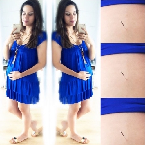 12.fev.2015 - Em post no Instagram, a atriz Fernanda Machado disse ter recorrido à acupuntura durante suas tentativas de engravidar