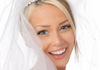 Veja dicas para conquistar um sorriso deslumbrante antes do seu casamento - Getty Images
