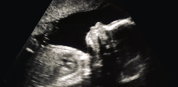 Pais teriam até 18ª semana de gravidez para optar se querem ou não ter responsabilidade pela criança - Getty Images