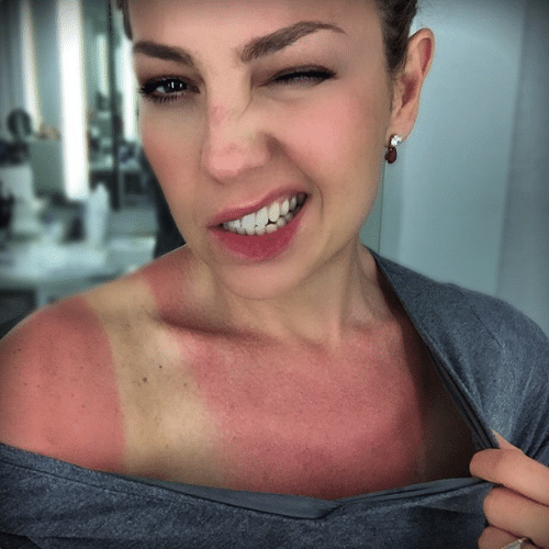 17.mar.2015 - Thalia toma sol na Flórida, ganha uma insolação no ombro e posta a imagem no Instagram na madrugada desta terça-feira