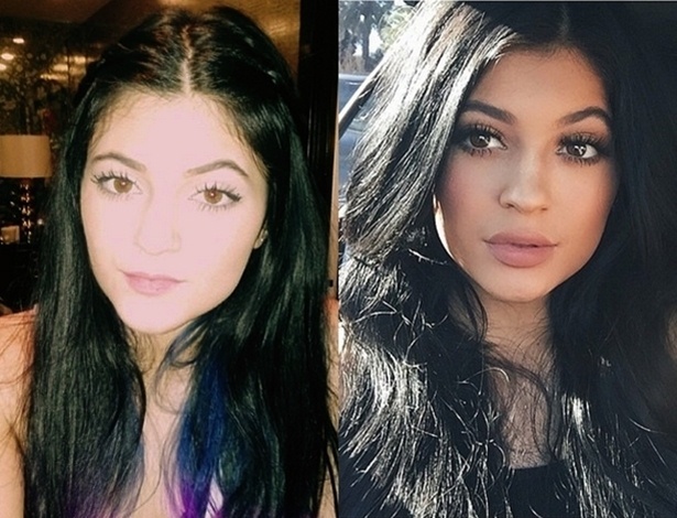 Mudanças nos lábios de Kylie Jenner chamam a atenção e fãs tentam imitar - Reprodução/Instagram/@kyliejenner