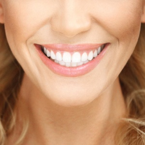 Clareamento dental, seja ele caseiro ou realizado em consultório, exige cuidados - iStock