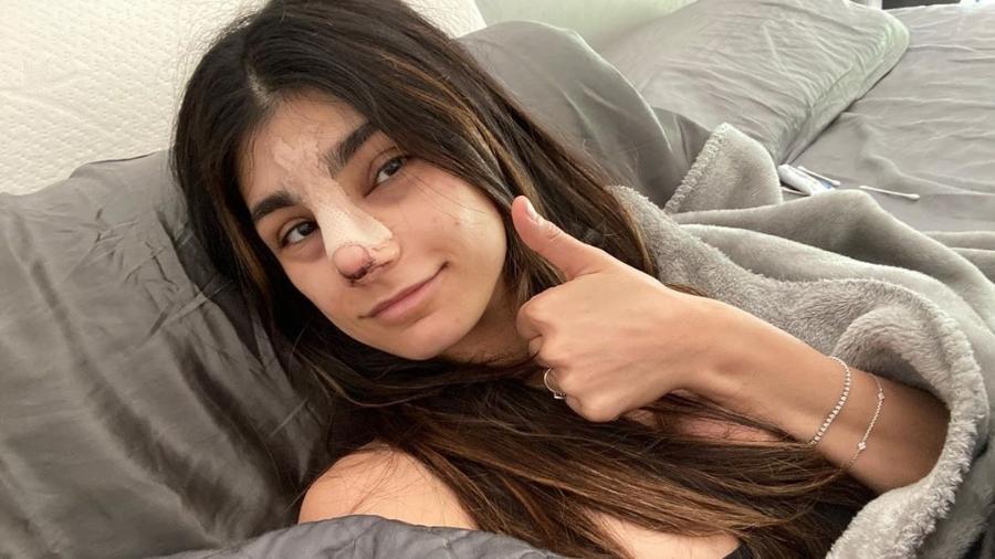 Mia Khalifa operou o nariz nos EUA - Reprodução/Instagram