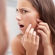 Acne cosmética: veja como evitar espinhas causadas por produtos de beleza - iStock