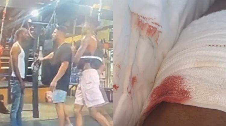 Blueface mostra perna machucada após confronto