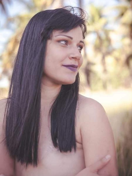 Mariana mastectomia - Arquivo pessoal - Arquivo pessoal