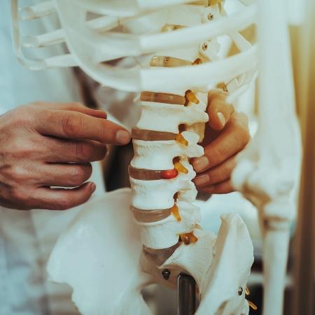 Remédio é esperança para o tratamento da osteoporose - Oleh Veres/iStock