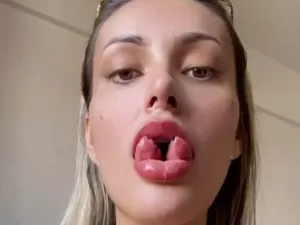 Andressa Urach exibe resultado final de bifurcação de língua; confira