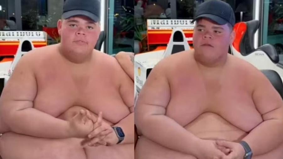 Após eliminar 130kg, 'Gordão da XJ' detalha jornada e prevê pelo menos dez cirurgias para remover excesso de pele