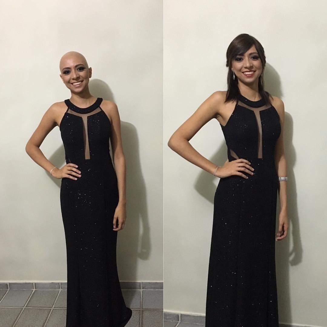 Cíntia no baile de formatura da sua turma de direito com a peruca que mandou customizar com seu próprio cabelo - Arquivo Pessoal