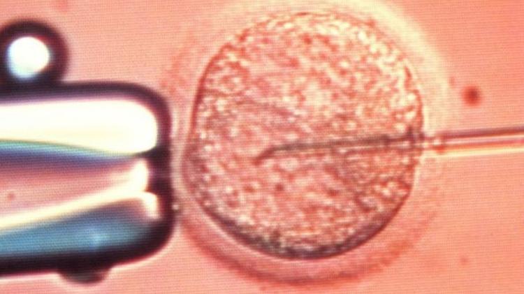 Família quer que óvulos sejam fecundados com sêmen de doador nos EUA - Science Photo Library/Reprodução - Science Photo Library/Reprodução