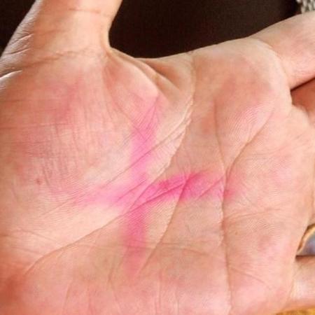 Vítima postou nas redes uma foto com o símbolo de uma cruz vermelha pintada na palma da mão, que é comumente usado por mulheres para pedir ajuda em casos de violência - Reprodução