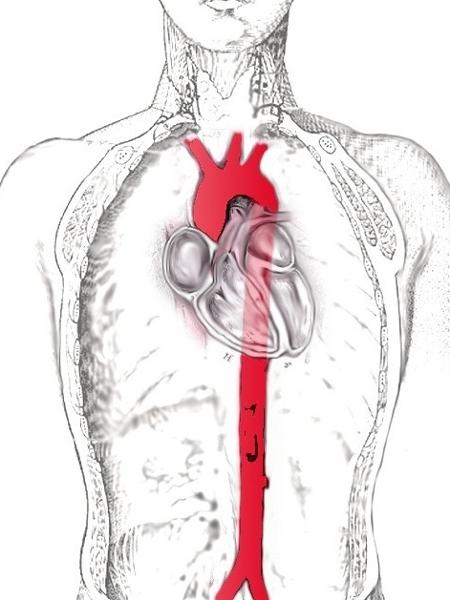 A aorta é a maior artéria do corpo humano