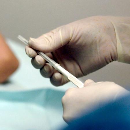O implante já é gratuito para mulheres em situação de vulnerabilidade em São Paulo - Getty Images