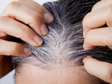 O estresse está deixando meu cabelo grisalho?