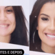 Bianca Andrade mostra antes e depois de seu sorriso - Reprodução/Instagram/@bianca