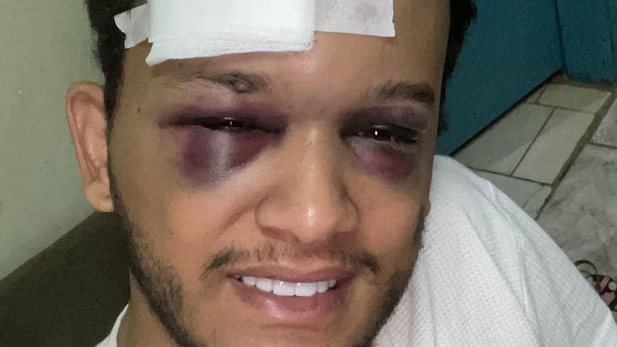 Hugo, da dupla sertaneja com Raphael, sofreu acidente em Mato Grosso do Sul Hugo, da dupla sertaneja com Raphael, sofreu acidente em Mato Grosso do Sul