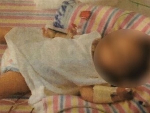 Casal é condenado por desnutrição de bebê com dieta vegana extrema - BBC  News Brasil
