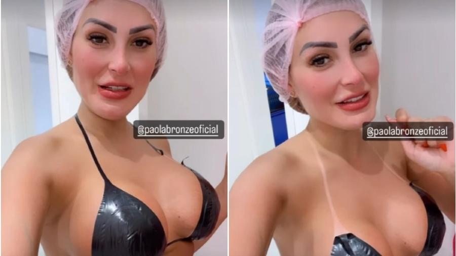 Andressa Urach apareceu usando fita preta e depois retirou - Reprodução/Instagram 