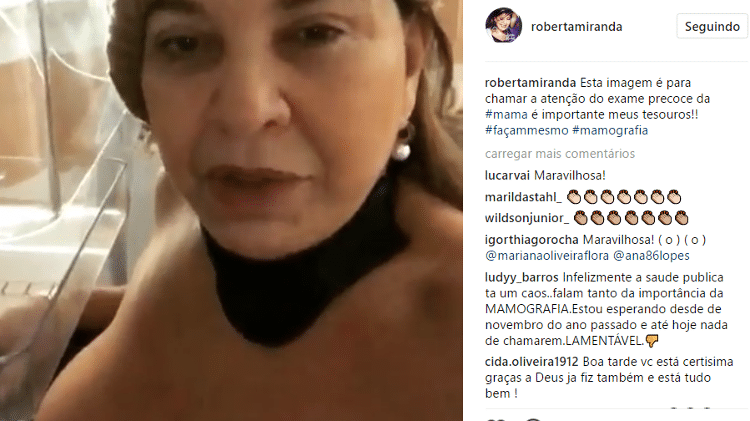 Roberta Miranda exibe seios em vídeo durante mamografia e fãs elogiam atitude - Reprodução/Instagram - Reprodução/Instagram