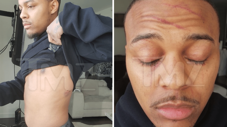 O ator Shad Moss mostra os machucados após briga com a namorada - Reprodução/TMZ - Reprodução/TMZ